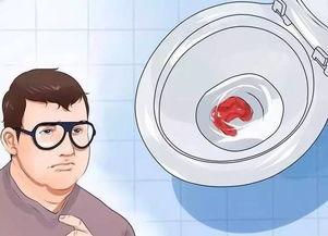 检查肛门图片,常见问题与预防措施  第3张